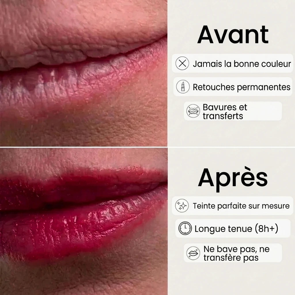 Avant Après lèvres