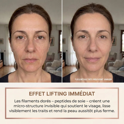 Effet lifting immédiat